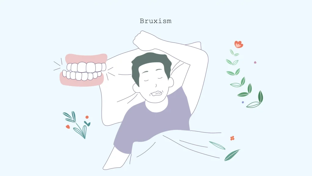 xxx Bruxism Bruxism: Teeth Grinding