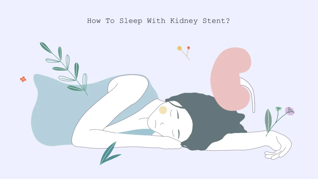 xxx How to sleep with kidney stent how to sleep with a kidney stent